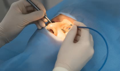 Διάγνωση και χειρουργική θεραπεία καταρράκτη